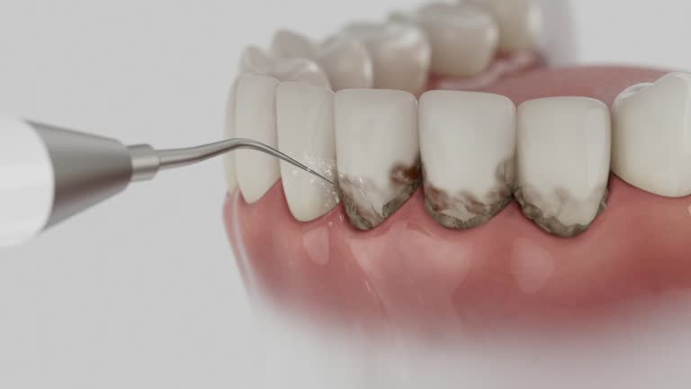 Trusted Root Canal Treatment service in Fort Riley, KS - Dentist Open Now